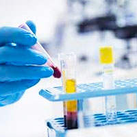 Evidence-Based Guidelines to Eliminate Repetitive Laboratory Testing