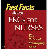fast-facts-about-ekgs-for-nurses-the-rules-of-identifying-ekgs-in-a-nutshell