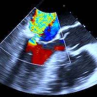 Expert Consensus on Methodology for Conducting and Reporting Echocardiography Research Studies