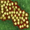 Acute Flaccid Myelitis Outbreak in Washington