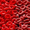 Fresh Red Blood Cell Transfusions No More Beneficial Than Older Red Blood Cells