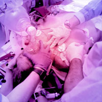 Haemostatic Resuscitation in Trauma: The Next Generation
