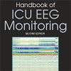 Handbook of ICU EEG Monitoring