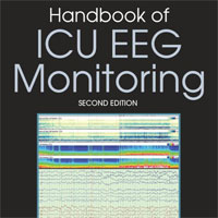 handbook-of-icu-eeg-monitoring
