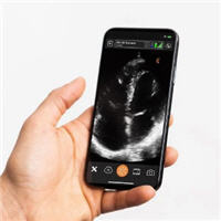 Handheld Ultrasound Device Usage and Image Acquisition Ability Among Internal Medicine Trainees