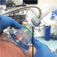 Head Rotation in Anaesthetised Apnoeic Patients Significantly Increases Mask Ventilation Efficiency