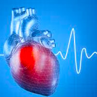 heart-rate-variability-in-critical-care-medicine