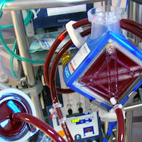 How Should ECMO Initiation and Withdrawal Decisions Be Shared?