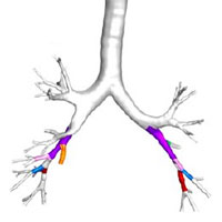 human-airway-branch-variation-and-copd