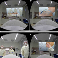 ICU-specific Virtual Reality for Psychological Recovery After ICU COVID-19 Treatment