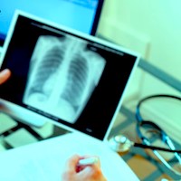 ICU Usage for Pneumonia Doubles Length of Hospital Stay