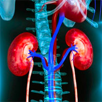 Impact of End-Stage Renal Disease and Acute Kidney Injury on ICU Outcomes in Patients With Sepsis