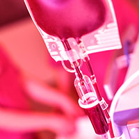 Impact of transfusion on patients with sepsis admitted in ICU