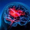 Increase in Rare Brain Inflammation and Stroke Linked to COVID-19