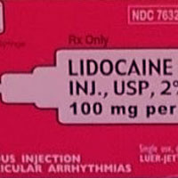 Intravenous Lidocaine To Reduce Propofol Burning And Response To Laryngoscopy