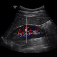 Kidney Imaging with Point-of-Care Doppler Ultrasonography
