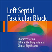 left-septal-fascicular-block