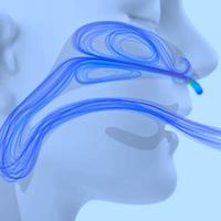 Looking for a Better Way to Treat Hypoxia in the Emergency Department? Reach for High-Flow Nasal Cannula