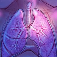 Lung Microbiome: Key to Respiratory Ills?