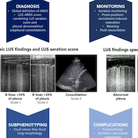 Lung Ultrasound for Diagnosis and Management of ARDS