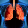 Here is Why COPD Disrupts Lung-Repair Ability