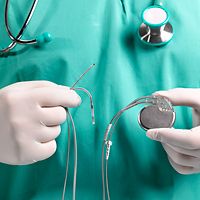 Magnet guidance reduces misplacement of subclavian vein catheter in ...