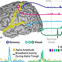 monitoring-the-relationship-between-changes-in-cerebral-oxygenation-and-electroencephalography