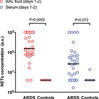 Neutrophil Extracellular Traps Are Elevated in Patients with Pneumonia-related ARDS
