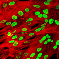 nih-herpesvirus-study-leads-to-discovery-of-potential-broad-spectrum-antiviral