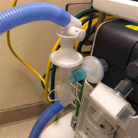optimizing-ventilator-use-during-the-covid-19-pandemic