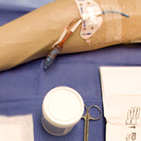 Peripherally Inserted Central Catheters in the ICU