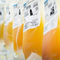 Is platelet transfusion associated with hospital-acquired infections in critically ill patients?