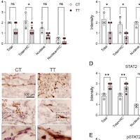 Polymorphism in Interferon Alpha/Beta Receptor Contributes to Glucocorticoid Response and Outcome of ARDS and COVID-19