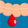 PPIs Should Not Be Prescribed for Upper GI Bleeds