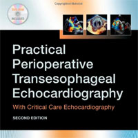 practical-perioperative-transesophageal-echocardiography