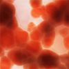 Probiotics Linked to Bloodstream Infections in ICU Patients