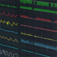 process-monitoring-in-the-icu