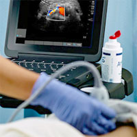 Prognostication with Point-of-Care Echocardiography During Cardiac Arrest (ALS)