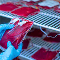 Prolonged Blood Storage and Risk of Posttransfusion AKI