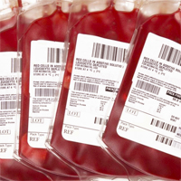 rbc-transfusions-are-associated-with-prolonged-mechanical-ventilation-in-pediatric-ards