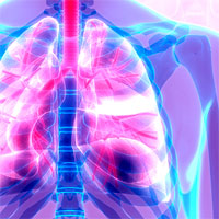 recommendations-for-a-standardized-pulmonary-function-report