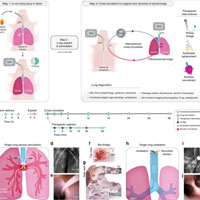 regeneration-of-severely-damaged-lungs-using-an-interventional-cross-circulation-platform