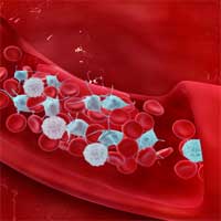 Research Shows Increased Thrombus Burden in COVID-19 Patients With STEMI