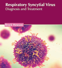 Respiratory Syncytial Virus: Diagnosis and Treatment