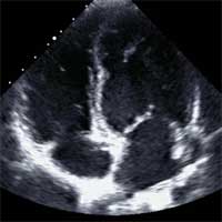 Safe Performance of Echocardiography During the COVID-19 Pandemic