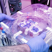 safety-and-feasibility-of-early-physical-therapy-for-patients-on-ecmo