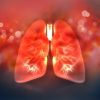 Scvo2 in Sepsis: A Measurement Provided by Respiratory Care Practitioners