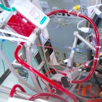 Sedation and Mobilization during Venovenous Extracorporeal Membrane Oxygenation for ARF
