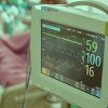 Sedation is Necessary to Minimize Patients’ Discomfort During Mechanical Ventilation