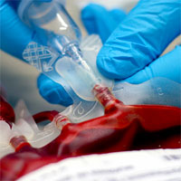 Should Transfusion Trigger Thresholds Differ for Critical Care vs Perioperative Patients?